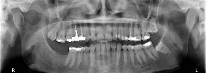 La importancia de la panoramica para realizar un diagnostico correcto.