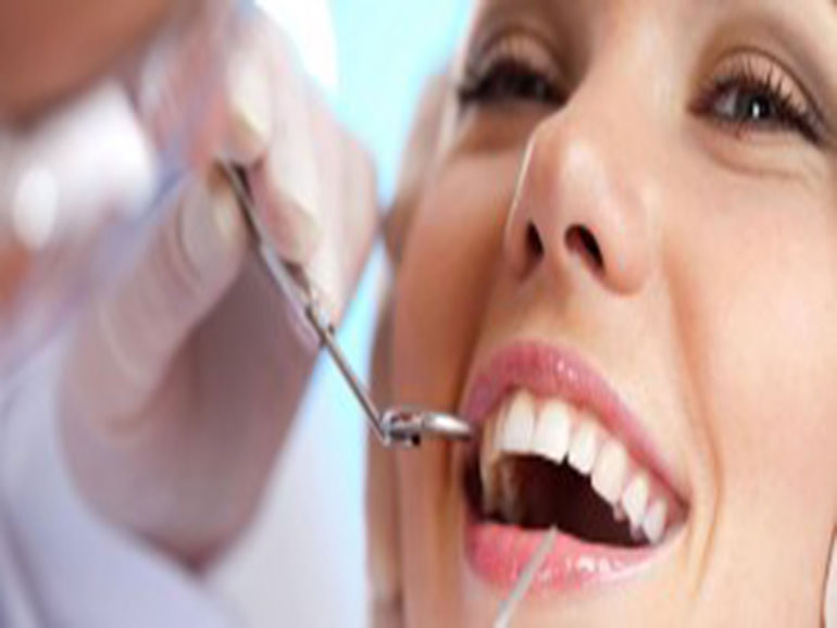 Estética Dental