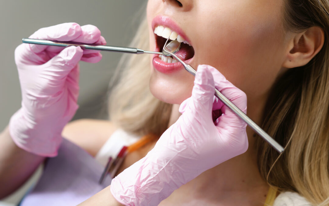 Erosión dental: descubre sus causas y cómo evitarla